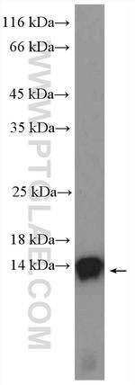 VAMP3/Cellubrevin Antibody in Western Blot (WB)