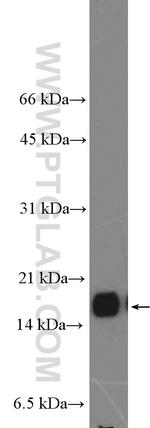 VAMP3/Cellubrevin Antibody in Western Blot (WB)