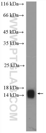 VAMP3/Cellubrevin Antibody in Western Blot (WB)