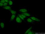NELFE Antibody in Immunocytochemistry (ICC/IF)