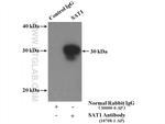 SAT1 Antibody in Immunoprecipitation (IP)