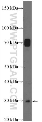 SAT1 Antibody in Western Blot (WB)