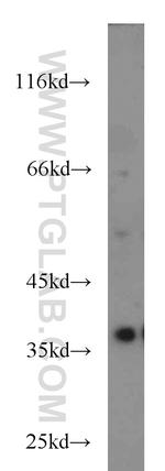 SIX1 Antibody in Western Blot (WB)