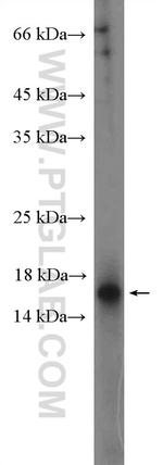 C1D Antibody in Western Blot (WB)