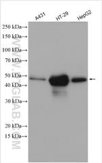 Cytokeratin 19 Antibody in Western Blot (WB)