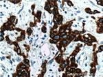 Cytokeratin 19 Antibody in Immunohistochemistry (Paraffin) (IHC (P))