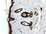 Cytokeratin 19 Antibody in Immunohistochemistry (Paraffin) (IHC (P))