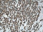 Cytokeratin 19 Antibody in Immunohistochemistry (Paraffin) (IHC (P))