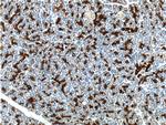 Cytokeratin 19 Antibody in Immunohistochemistry (Paraffin) (IHC (P))