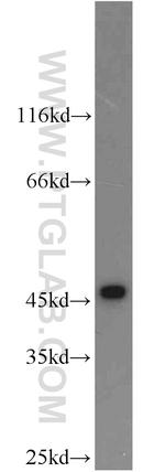 Cytokeratin 19 Antibody in Western Blot (WB)