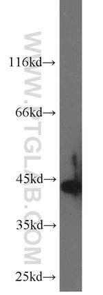 Cytokeratin 19 Antibody in Western Blot (WB)