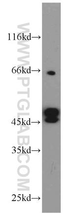 Cytokeratin 19 Antibody in Western Blot (WB)