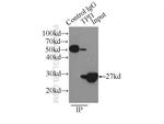 TPI1 Antibody in Immunoprecipitation (IP)