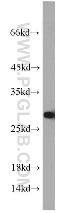 TPI1 Antibody in Western Blot (WB)