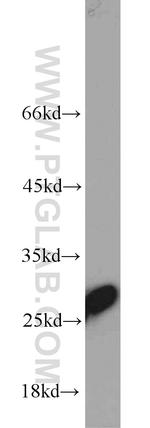 TPI1 Antibody in Western Blot (WB)