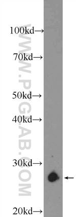 TPI1 Antibody in Western Blot (WB)