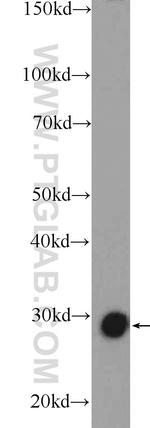 TPI1 Antibody in Western Blot (WB)