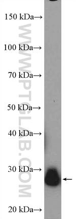 TPI1 Antibody in Western Blot (WB)