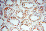 Cyclophilin A Antibody in Immunohistochemistry (Paraffin) (IHC (P))