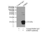 CSRP3 Antibody in Immunoprecipitation (IP)