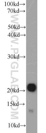 CSRP3 Antibody in Western Blot (WB)