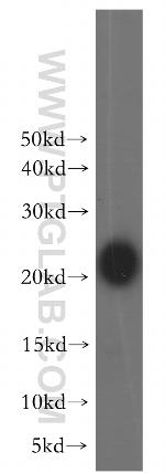 CSRP3 Antibody in Western Blot (WB)