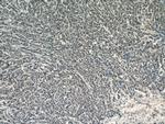 KU70 Antibody in Immunohistochemistry (Paraffin) (IHC (P))