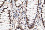 KU70 Antibody in Immunohistochemistry (Paraffin) (IHC (P))