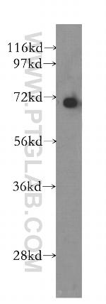 KU70 Antibody in Western Blot (WB)