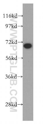 KU70 Antibody in Western Blot (WB)