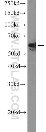 KU70 Antibody in Western Blot (WB)