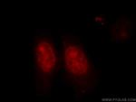 KU70 Antibody in Immunocytochemistry (ICC/IF)