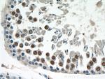 KU70 Antibody in Immunohistochemistry (Paraffin) (IHC (P))