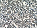 KU70 Antibody in Immunohistochemistry (Paraffin) (IHC (P))