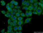 NRAS Antibody in Immunocytochemistry (ICC/IF)