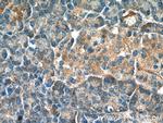 NRAS Antibody in Immunohistochemistry (Paraffin) (IHC (P))