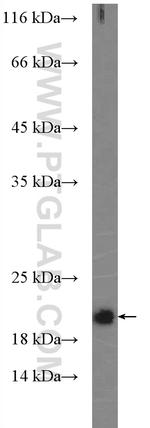 NRAS Antibody in Western Blot (WB)