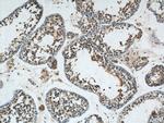 NRAS Antibody in Immunohistochemistry (Paraffin) (IHC (P))