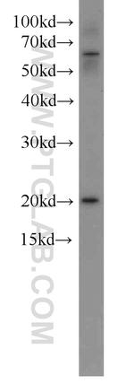 NRAS Antibody in Western Blot (WB)