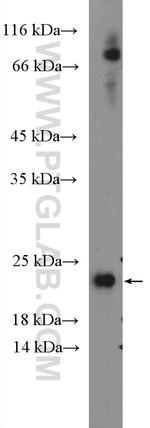 NRAS Antibody in Western Blot (WB)