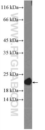 NRAS Antibody in Western Blot (WB)