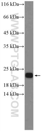 NRAS Antibody in Western Blot (WB)