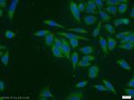 ATIC Antibody in Immunocytochemistry (ICC/IF)