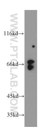 ATIC Antibody in Western Blot (WB)