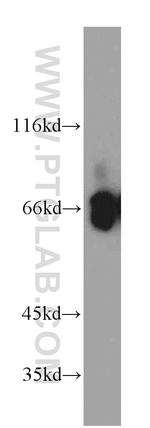 ATIC Antibody in Western Blot (WB)