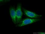 Ferritin light chain Antibody in Immunocytochemistry (ICC/IF)