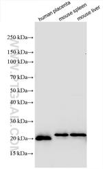 Ferritin light chain Antibody in Western Blot (WB)