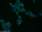 Ferritin light chain Antibody in Immunocytochemistry (ICC/IF)