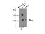 Ferritin light chain Antibody in Immunoprecipitation (IP)