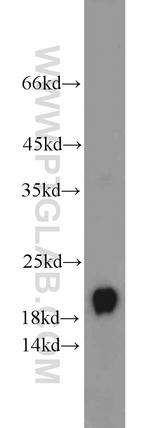 Ferritin light chain Antibody in Western Blot (WB)